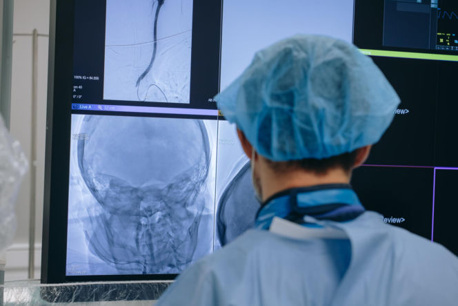 To prawdopodobnie najlepszy szpital leczący udary mózgu. USK nr 4 w Lublinie ze światowym wyróżnieniem