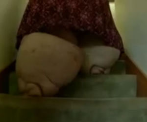 Ta kobieta waży ponad 300 kg! Szoruje fałdy tłuszczu na nogach szczotką do mycia pleców! [ZDJĘCIA]