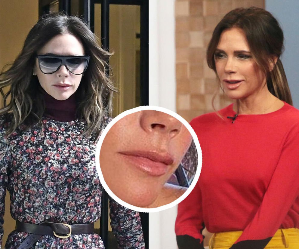 Victoria Beckham - co ona zrobiła z ustami. Fani zniesmaczeni