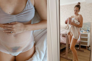 Mama fotografowała swoją bliznę po cesarce codziennie od pierwszej doby. Drastyczne, ale zgodne z prawdą
