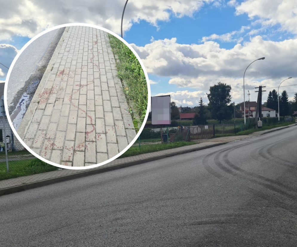 Leżajsk. Obciął dłoń maczetą [ZDJĘCIA]