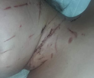 Ojciec pociął nożem 6-letnią Julkę. Rodzina zbiera pieniądze na operację