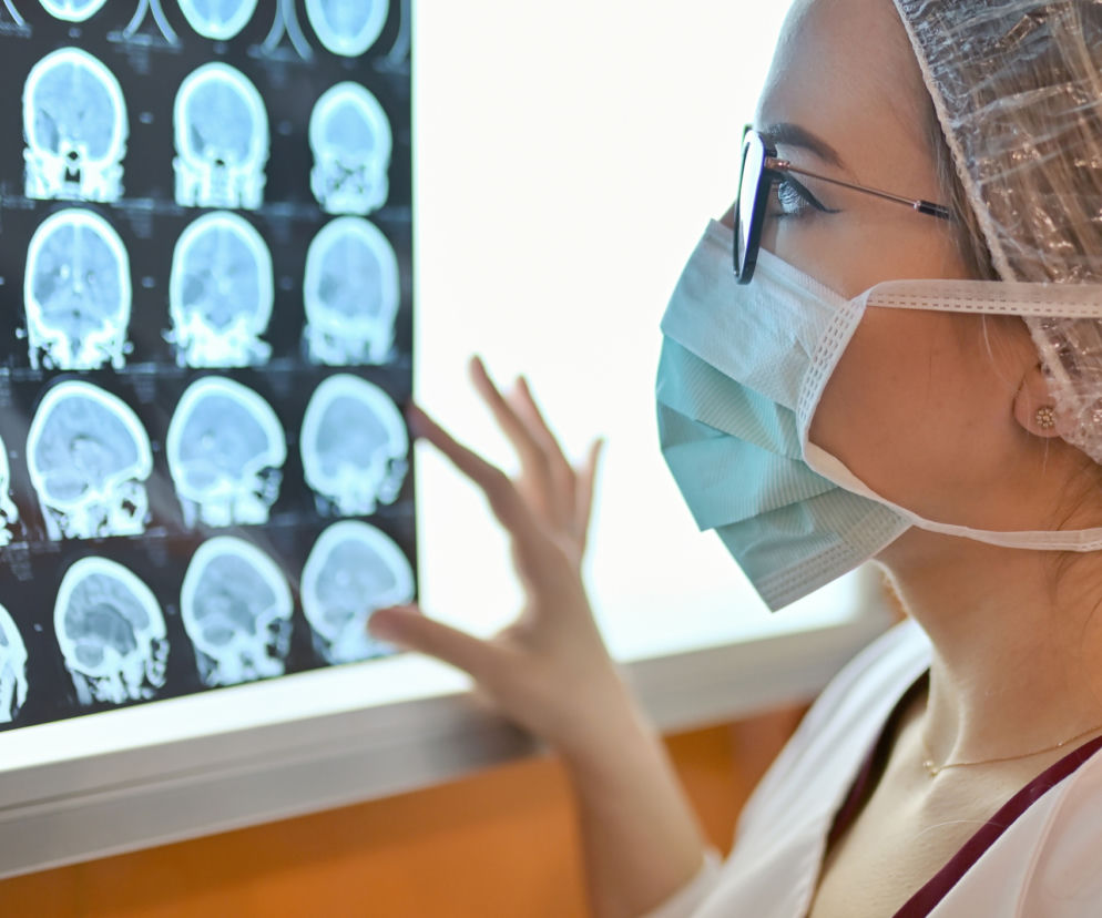 Lekarka w maseczce analizuje zdjęcia mózgu. O kosztach diagnostyki neurologicznej przeczytasz na Poradnik Zdrowie.