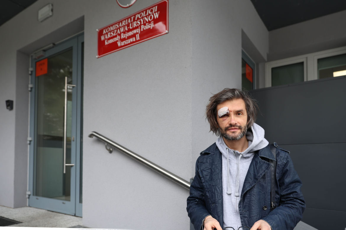 Profesor Politechniki Warszawskiej został pobity jak wracał z koncertu 