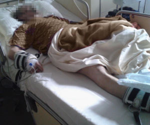 Mińsk Mazowiecki. Zatruł się czadem, gdy ratował Mruczka