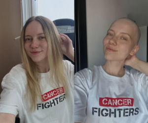 Gwiazdy zgoliły głowy w szczytnym celu