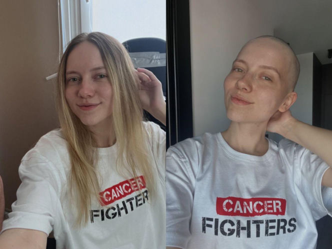 Gwiazdy zgoliły włosy w szczytnym celu