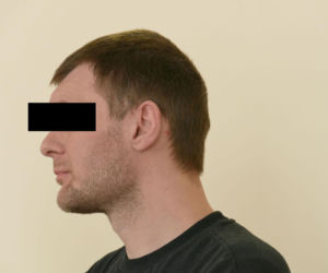 Michał jest inwalidą, bo kolega skatował go nożycami