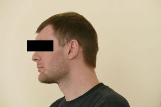 Michał jest inwalidą, bo kolega skatował go nożycami