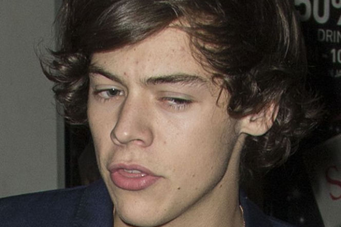 Harry Styles 
