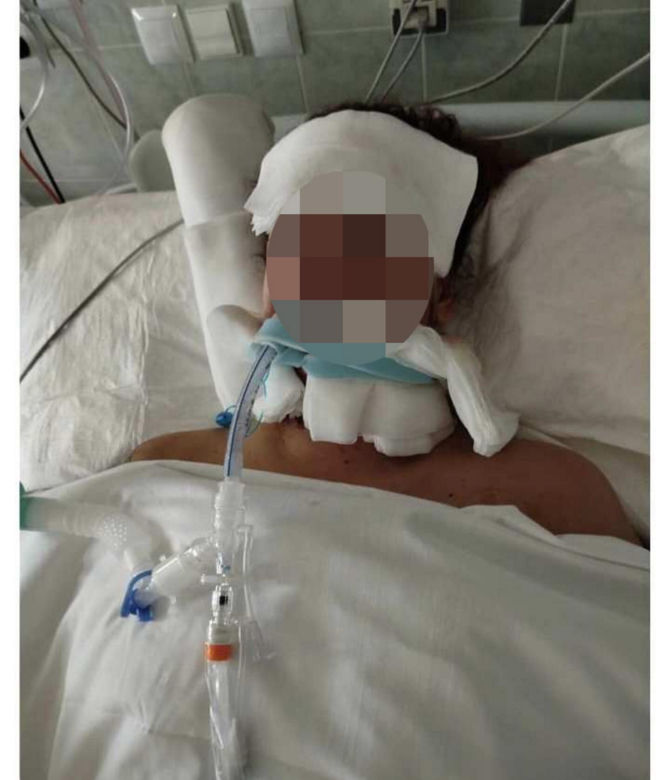 Matka ofiary wypadku na Trasie Łazienkowskiej chce zabrać córkę na leczenie do Szwecji. Czy 20-latka pamięta coś z tej tragedii? 