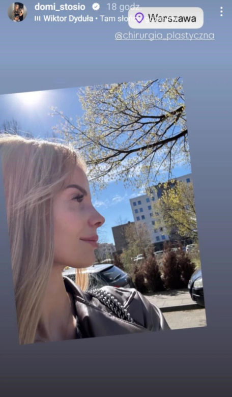 Dominika z "Hotelu Paradise" przeszła operację nosa. Pokazała efekty zabiegu