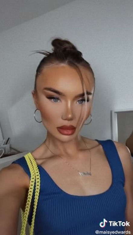 Znana influencerka pojechała do Turcji "zrobić" sobie nos. Wydała 50 tys. zł, fani bezlitośni: "Jest gorzej"