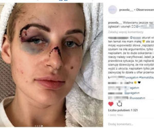 pobita dziewczyna trener osobisty