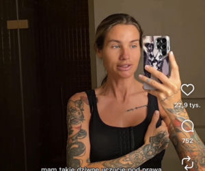 Karolina Gilon zoperowała biust. Zdjęcia przed i po