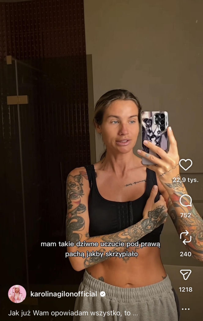 Karolina Gilon zoperowała biust. Zdjęcia przed i po