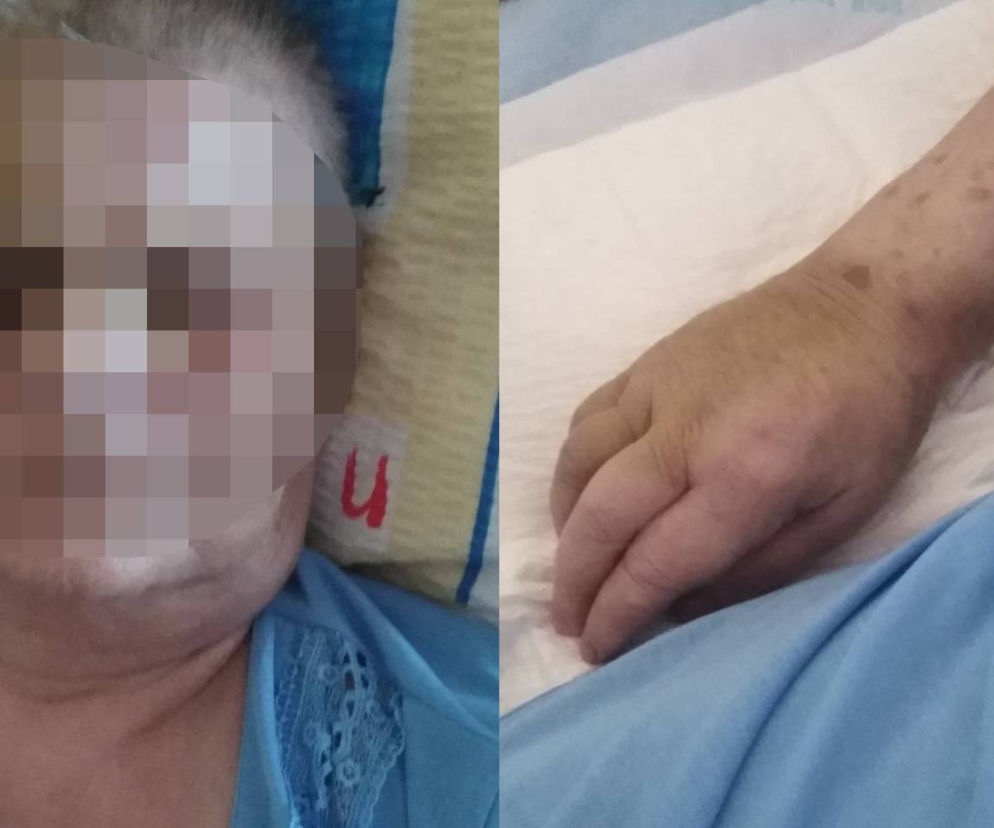 Siniaki i krwiaki na ciele pacjentki. Jak do tego doszło?