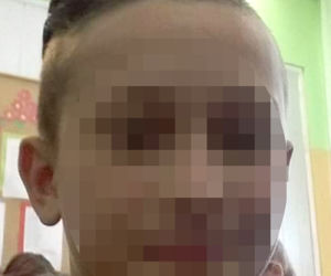Jeńki. Czołowe zderzenie motorowerów - nastolatek zginął na miejscu, drugi ranny
