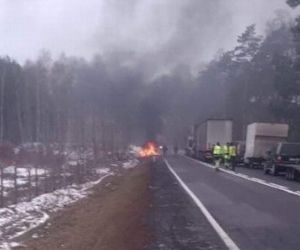 Auto spłonęło, 10-latek ciężko poparzony. Jego ciało pokryły przerażające blizny! [DRASTYCZNE ZDJĘCIA]