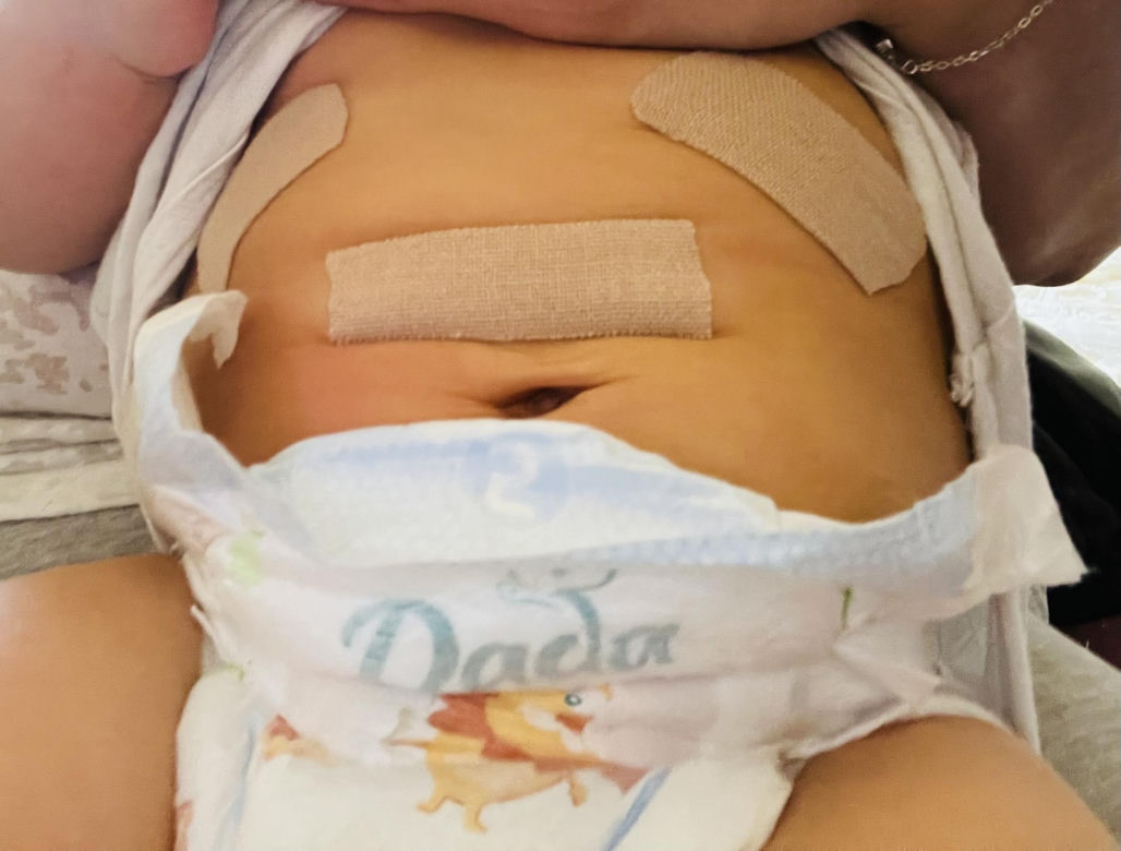 15-miesięczna Anastazja z Torunia potrzebuje pomocy