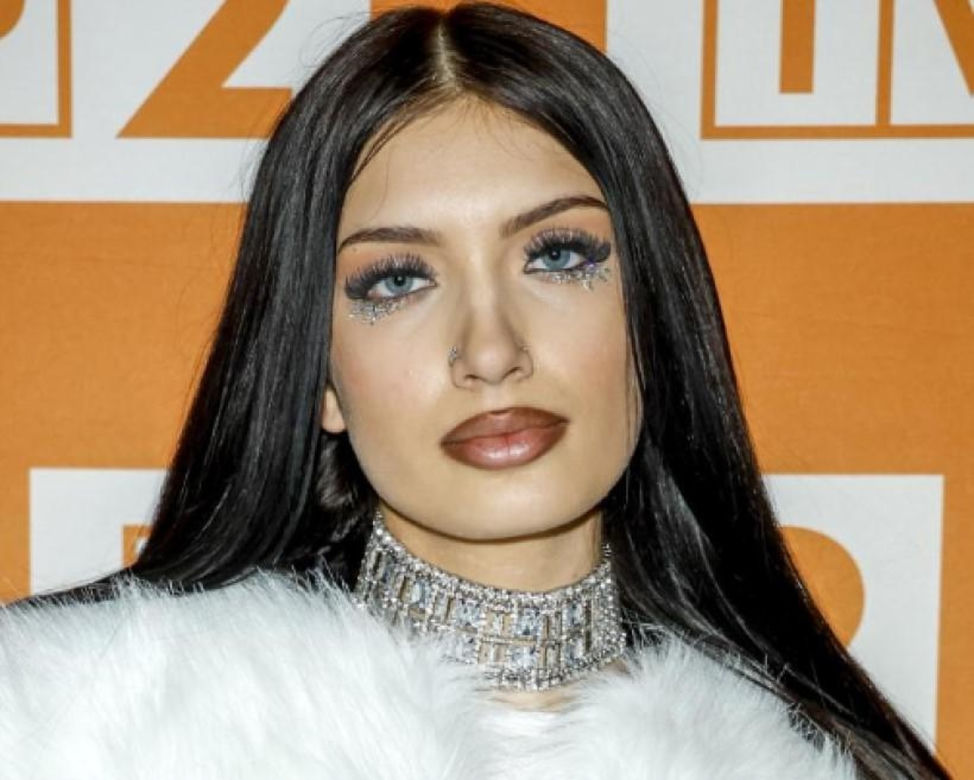 Viki Gabor powiększyła usta? Fani nie mają wątpliwości