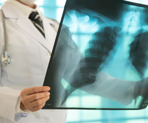 Miliony Polaków chorują, ale prawie nikt o tym nie wie. Kaszel i brak tchu mogą być groźnym ostrzeżeniem