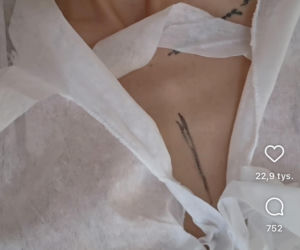 Karolina Gilon zoperowała biust. Zdjęcia przed i po