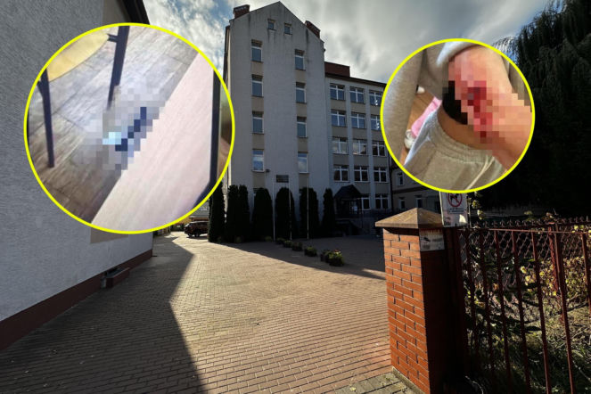 Jakub Z. miał siekierę, nóż i maczetę! Mamy makabryczne zdjęcia. Wszędzie krew!