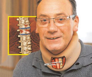 Dariusz Szpakowski mógł stracić głos. Szczegóły operacji
