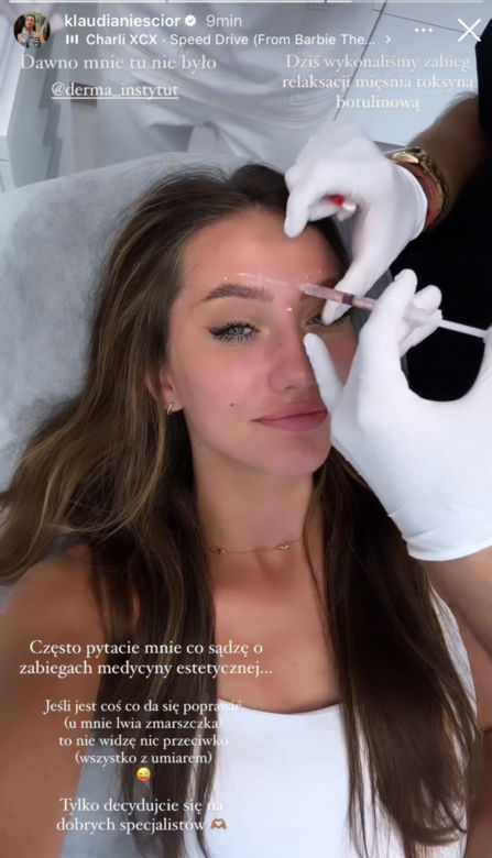 Top Model Klaudia Nieścior robi botoks