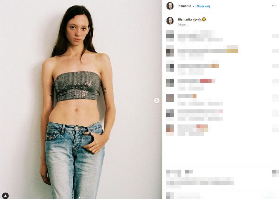 Koszmarny wypadek pięknej modelki. Jej twarz i ręce niemal spłonęły. Wieniawa apeluje o pomoc