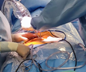 Pierwsza w Polsce operacja dyskopatii u nastolatka