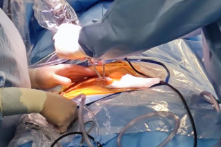 Pierwsza w Polsce operacja dyskopatii u nastolatka