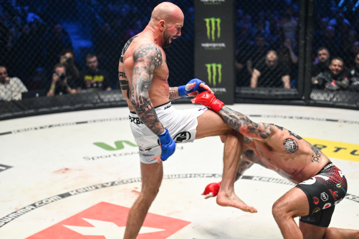 Paczuski: Potworne rozcięcie na twarzy gwiazdy KSW