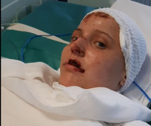 Justyna ucierpiała w poważnym wypadku