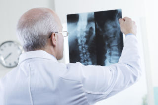 OSTEOMALACJA - choroba metaboliczna KOŚCI