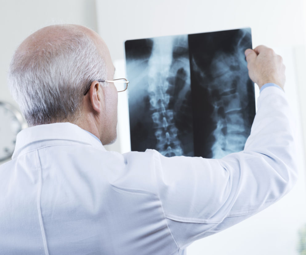 OSTEOMALACJA - choroba metaboliczna KOŚCI