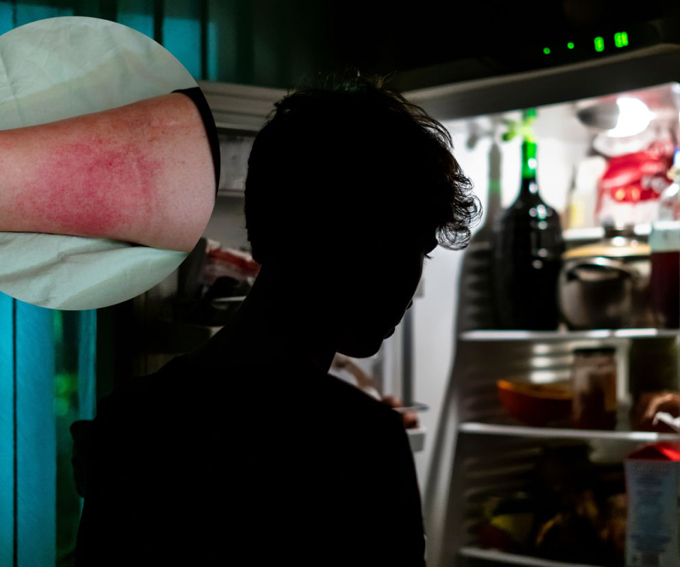 Koszmar w akademiku. Zjadł resztki jedzenia swojego współlokatora, amputowali mu nogi