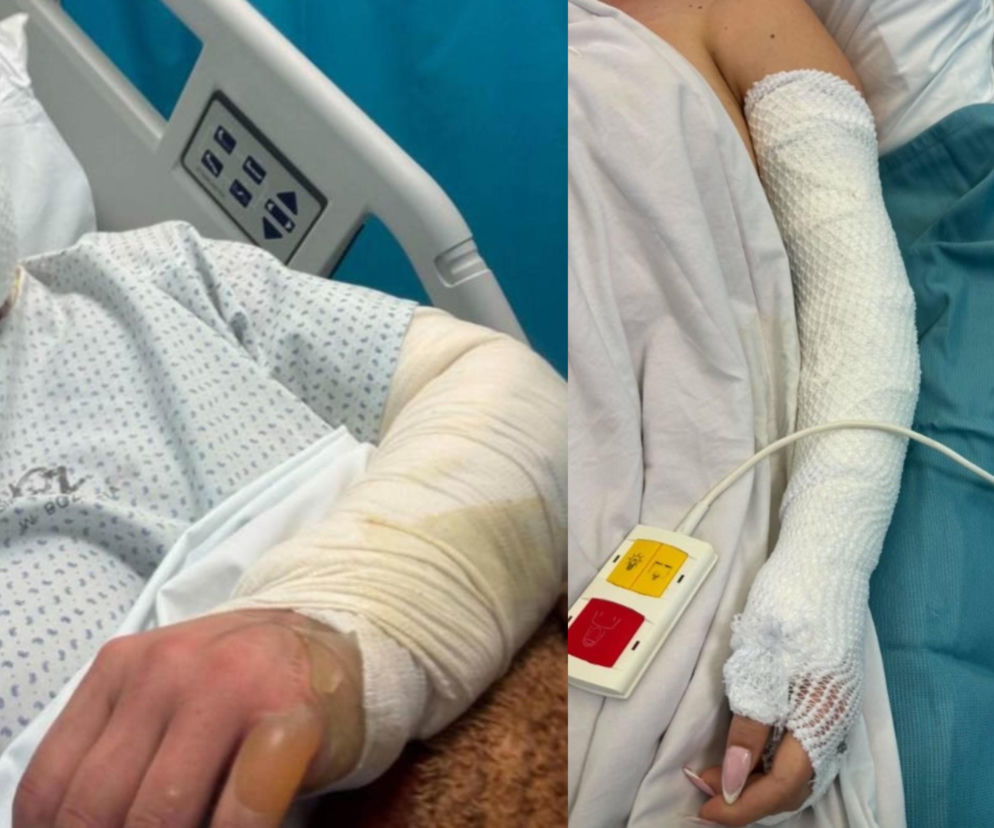 Dzień Matki zamienił się w horror. Judyta została ciężko poparzona, trwa walka o jej powrót do zdrowia