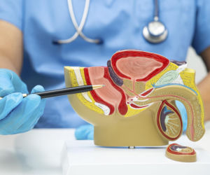 Terapia radioligandowa: Przełom w onkologii