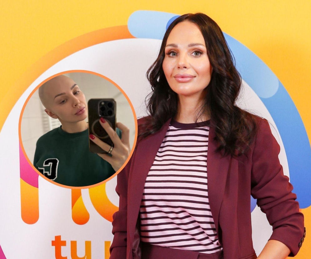 Uczestniczka Farmy zmaga się z nowotworem. Opowiedziała o leczeniu