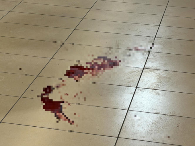 Bójka na Targówku zakończona tragedią. Jeden z mężczyzn spadł z pierwszego piętra. Nie żyje