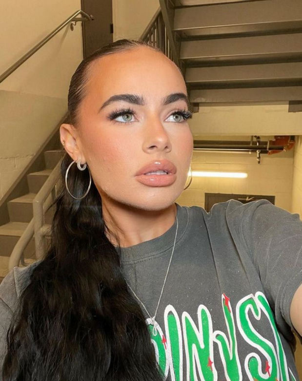 Jej usta prawie wybuchły po darmowym zabiegu. Dramat influencerki. "Najgorszy dzień w życiu"