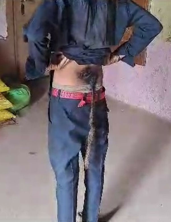 Suresh 