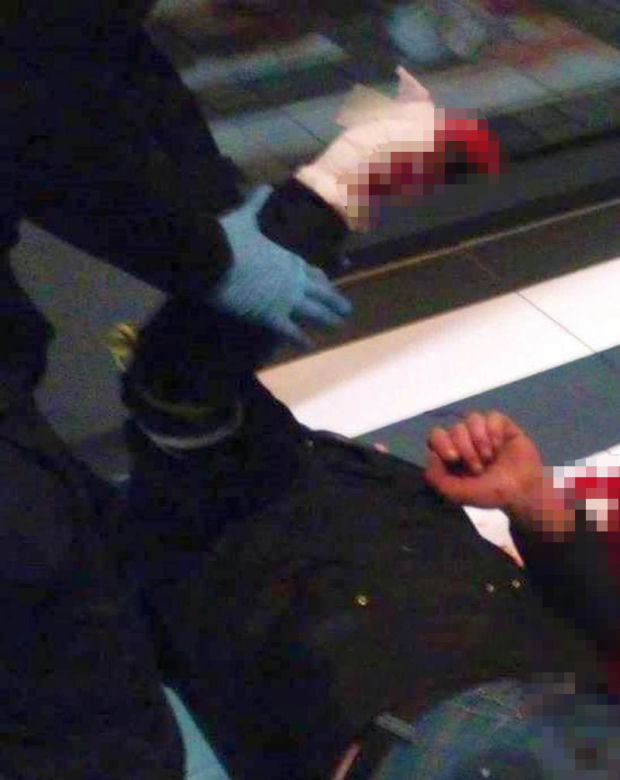 Horror na Mińskiej. Mężczyzna leżał w wielkiej kałuży krwi