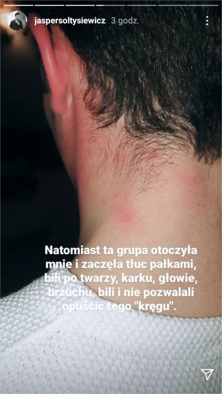 Gwiazdror "Barw szczęścia" oskarża policję o brutalne pobicie