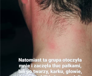 Gwiazdror Barw szczęścia oskarża policję o brutalne pobicie