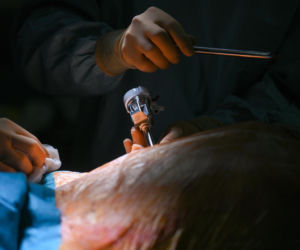 Polscy lekarze z Chin zoperaowali pacjentów w Warszawie. To pierwsze w historii operacje telerobotyczne na taką odległość