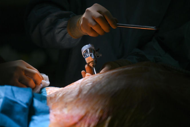 Polscy lekarze z Chin zoperaowali pacjentów w Warszawie. To pierwsze w historii operacje telerobotyczne na taką odległość