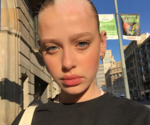 Modelka z bielactwem, którą odkryła Rihanna robi furorę